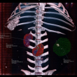 Analyse de rein de brebis par CT-scan