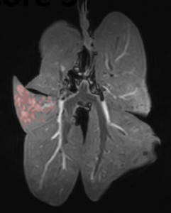 IRM poumon de blaireau